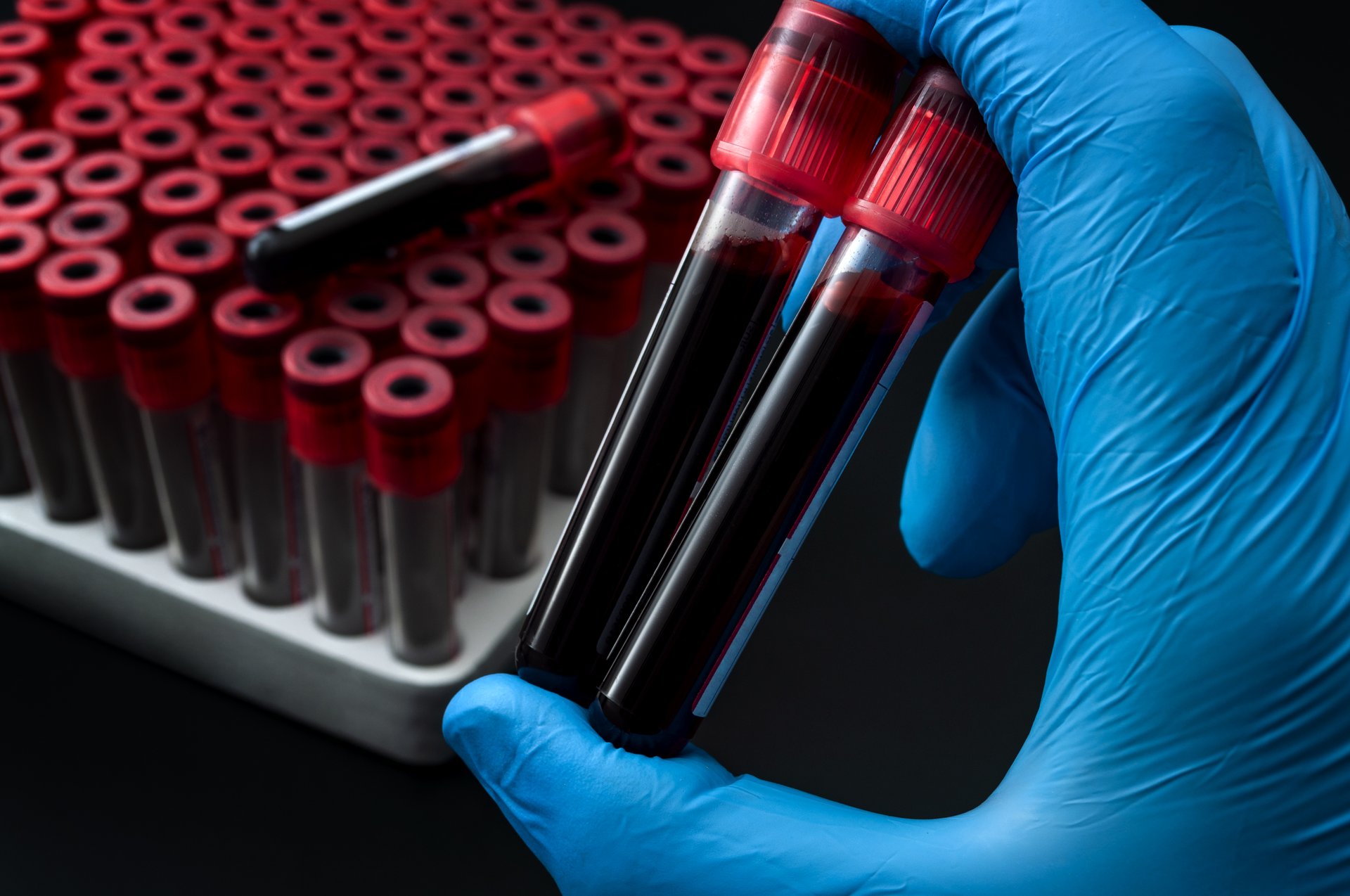 Zkumavky s krví – screening kolorektálního karcinomu z krve